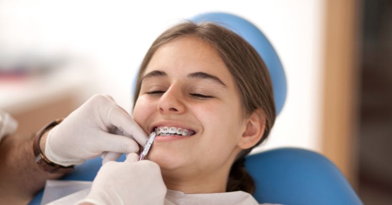 Dental Crowns Fort Worth