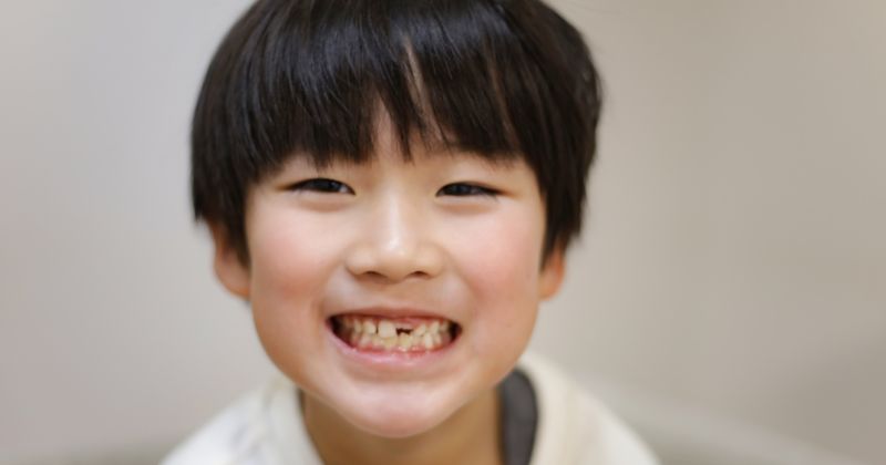 Dentures in Fort Worth