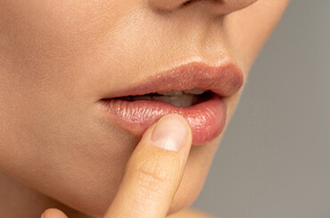 Frenectomy (Lip/Tongue tie)